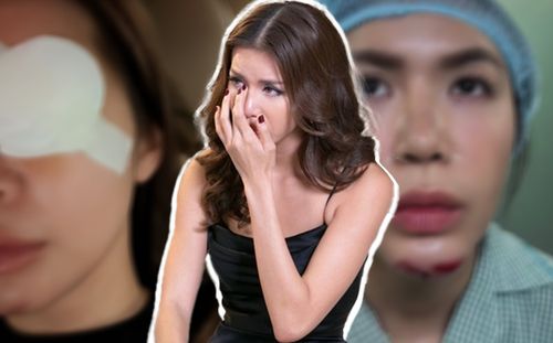 Minh Tú tiếp tục gây lo lắng hậu bị tai nạn phải khâu hơn 10 mũi: Hết cằm lại tới mắt!