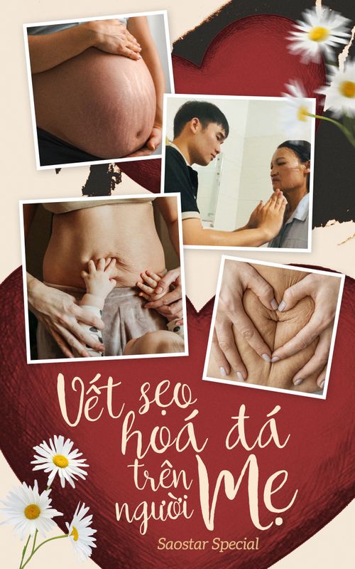 Vết sẹo hoá đá trên người mẹ: Nỗi đau kiêu hãnh nhất khi vẽ nên cuộc đời hoàn hảo cho con