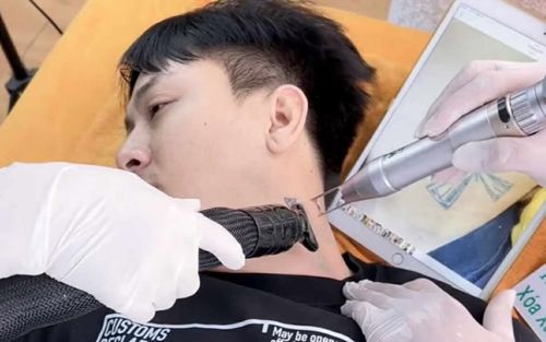 Đoạn clip Hoài Lâm xóa hình xăm trên cổ gây xôn xao