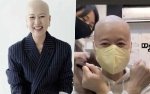 Xót xa hình ảnh mới của nữ danh hài nổi tiếng showbiz sau 16 đợt xạ trị ung thư