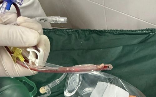 Thương tâm bé gái 3 tuổi tử vong sau khi bị ho sặc lúc ăn ở nhà trẻ