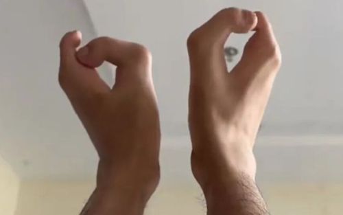 Người đàn ông sinh ra với bàn chân 'móng bò' và tay 'càng cua', lý do ai nghe cũng xót xa