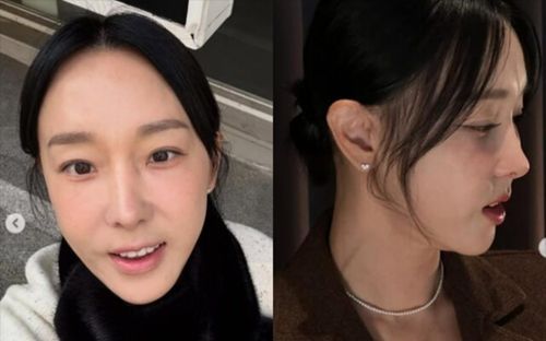 Không nhận ra khuôn mặt của Lee Ji Hye sau phẫu thuật thẩm mỹ ở tuổi 45