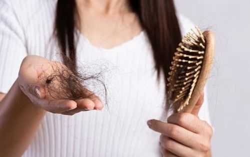 Tóc rụng hàng loạt vì nội tiết tố rối loạn: Chị em cần làm gì để cứu vãn?