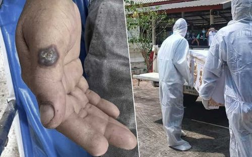 1 người tử vong, hàng trăm người nhiễm bệnh sau khi ăn thịt bò