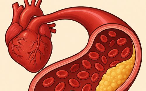 Đừng chờ đến khi mỡ máu cao mới xử lý, loại gia vị này là 'vị cứu tinh' âm thầm hay bị bỏ qua