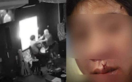 Nam ca sĩ bị đánh rách môi khi đang hát, đoạn clip ghi lại sự việc ai xem cũng phẫn nộ