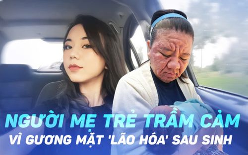 Người mẹ trẻ trầm cảm vì gương mặt 'lão hóa' sau sinh, biến đổi đến mức không nhận ra