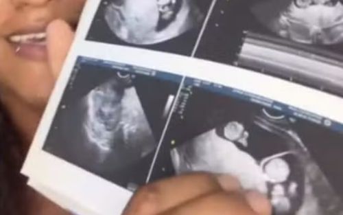 Đang mang thai, người phụ nữ 24 tuổi nhận cú sốc khó tin khi đi siêu âm