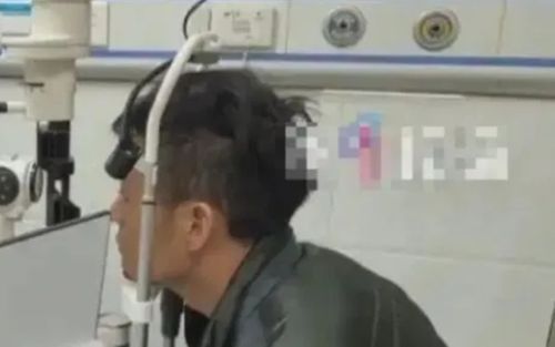 Đau mắt suốt nhiều năm, người đàn ông sốc khi bác sĩ gắp ra thứ bên trong