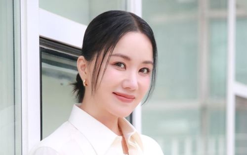 Uhm Jung Hwa gặp chấn thương nghiêm trọng trong chuyến du lịch