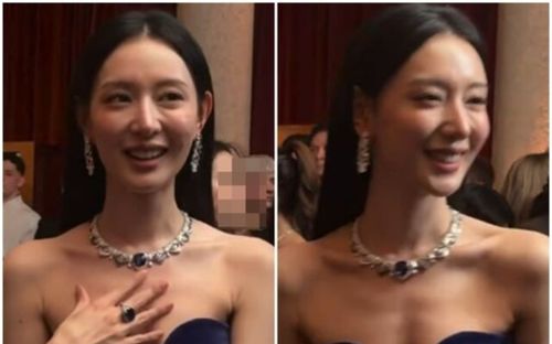 Kim Ji Won khiến fans lo lắng vì diện mạo mới