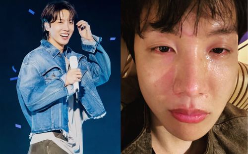 J-Hope (BTS) đăng ảnh nước mắt giàn giụa, gương mặt sưng húp khiến fan xót xa