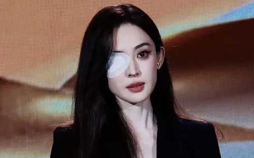 Tình trạng đáng lo của Cổ Lực Na Trát