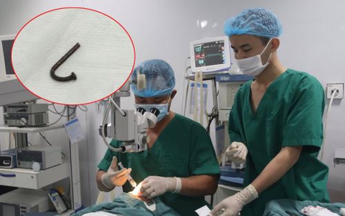 Bé gái 19 tháng tuổi bị đinh dài 3 cm đâm xuyên mắt
