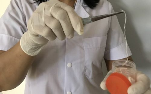 Người đàn ông bị giun rồng ký sinh trong đùi sau nhiều năm 'nghiện' tiết canh và các món tái sống