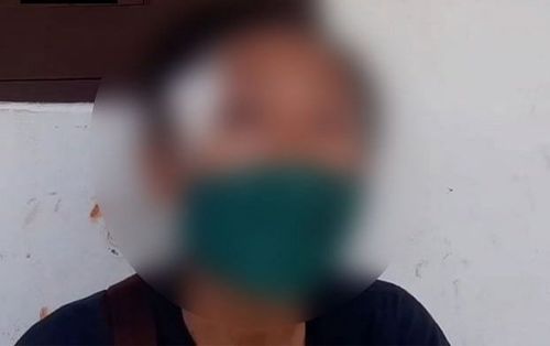 Dùng ổ khóa niêm phong 'cậu nhỏ' để chứng minh tình yêu với bạn gái, thanh niên phải nhập viện cấp cứu
