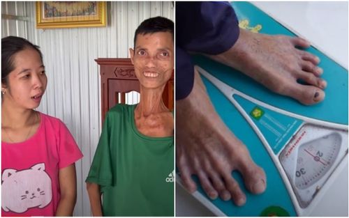 Người đàn ông 'ăn mãi chẳng lớn' chỉ nặng 20kg, vẫn đau đau khát khao 2 vợ chồng có một thiên thần nhỏ