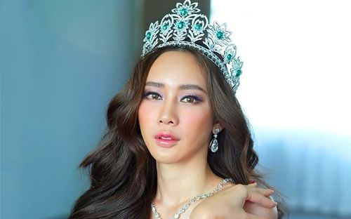 Hoa hậu Thái Lan 'trả giá' đắt vì phẫu thuật thẩm mỹ