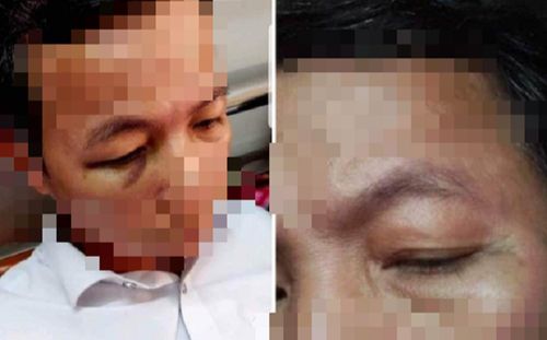 Thầy hiệu trưởng đấm hiệu phó nhập viện