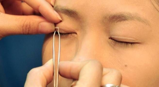 Chỉ tạo mí mắt - kiểu làm đẹp nguy hiểm