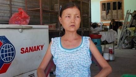 Cô gái mỗi bữa ăn 6 lon gạo, uống 15 lít nước một ngày