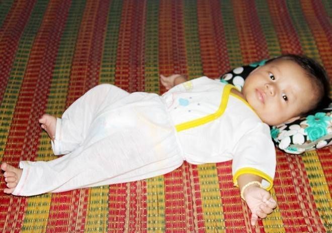 Bé trai kiến cắn khắp người bụ bẫm khi tròn 3 tháng