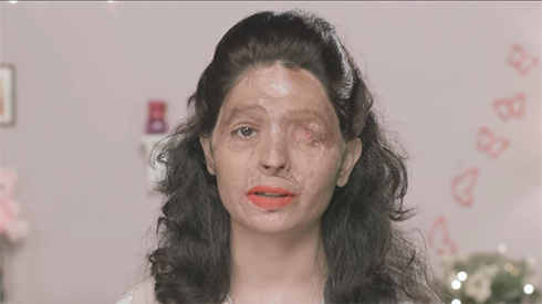 Ấn tượng với clip hướng dẫn make up của cô gái bị tạt axit