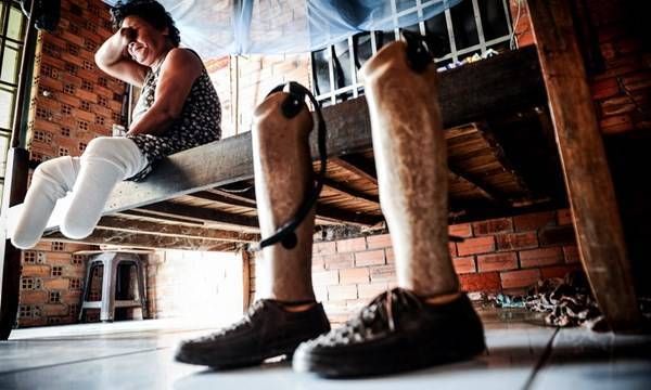 Đi mổ sạn thận bị cắt tứ chi: Chi 60 triệu đồng để mua im lặng?