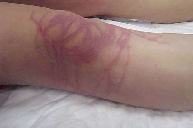 Bị sứa cắn khi đang tắm biển, một du khách Đức tử vong ở Thái