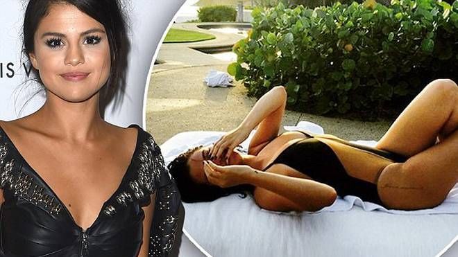 Selena Gomez điều trị tâm lý vì bị chê béo
