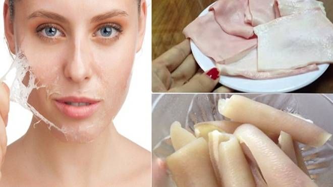 Mặt nạ collagen làm từ da heo có thực sự hiệu quả?