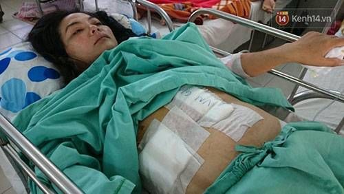 Người vợ bị tai nạn nguy kịch: 'Chồng lái xe kéo lê tôi trên đường rồi bỏ chạy…'