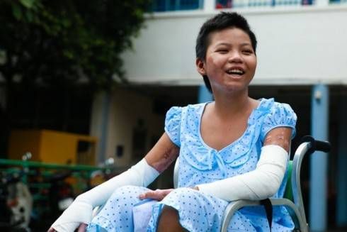 Nụ cười ngày ra viện của cô bé bán vé số bị mẹ đốt