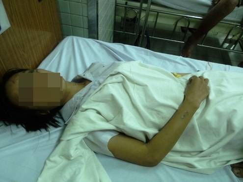 Bắt nghi phạm 18 tuổi hận tình, tạt axit hai nữ sinh ở quận 9