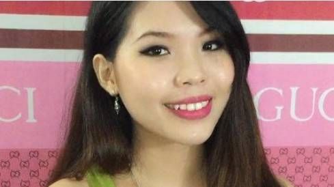 Điều trị mụn nội tiết: Có nên uống thuốc ngừa thai?