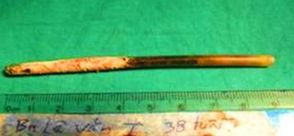 Phát hiện ruột bút bi trong 'của quý'