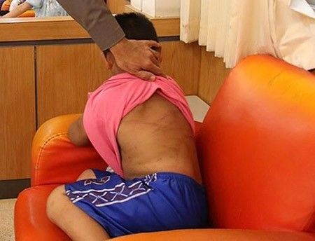 Phẫn nộ với sự thật bức ảnh về em bé bị dì ghẻ hành hạ vì ăn cắp vặt