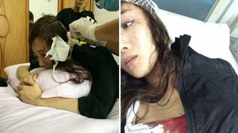 Sao Hoa ngữ hoang mang vì vấn nạn nguy hiểm trong phim trường