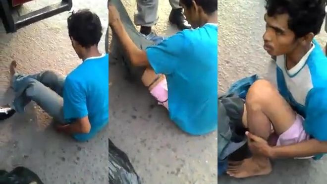 Ngỡ ngàng trước công nghệ làm cụt chân của giới ăn xin