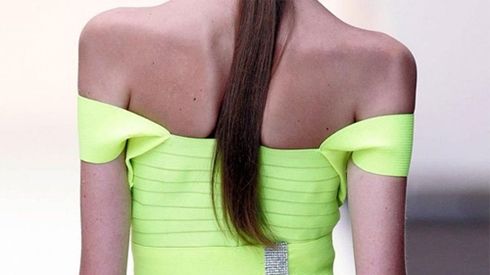 Bi kịch chân dài siêu gầy 'hết đất sống' ở Pháp