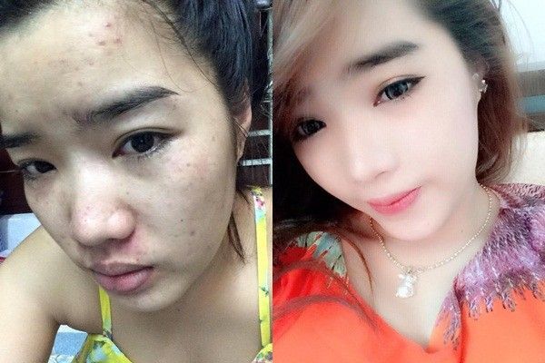 Chiêu trò PR mới: Công khai mặt mộc lấy lòng thương hại