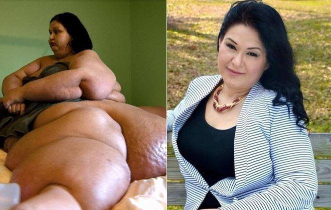 Người phụ nữ nặng gần 500kg 'lột xác' ngoạn mục