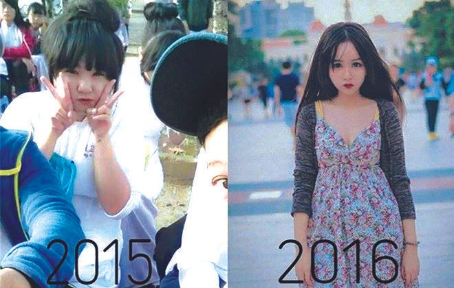 Nữ sinh giảm 17kg vì bị chỉ trỏ, bàn tán