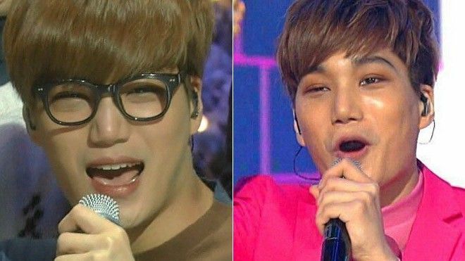 Kai (EXO) bị nghi gặp phản ứng phụ vì dao kéo