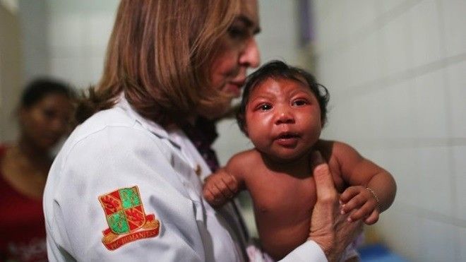 Không phải Zika mà hóa chất của Monsanto gây teo não?