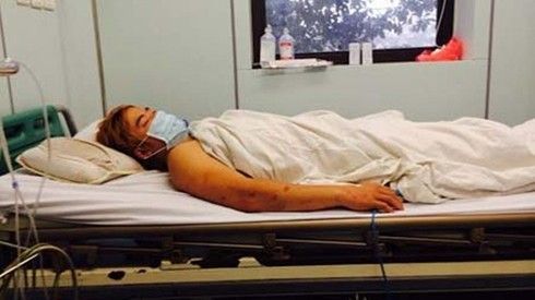 Bộ Y tế chỉ đạo khẩn về việc phòng chống viêm màng não mô cầu