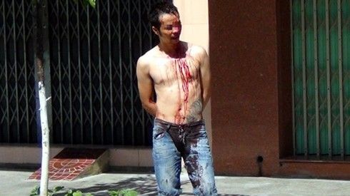 Thanh niên ngáo đá, tự rạch mình ở Bình Định
