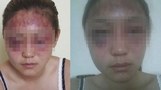 DJ nổi tiếng, giỏi võ Sài Gòn bị tố đánh đập vợ tàn nhẫn