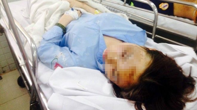 Vụ nữ sinh bị tạt a xít ở Sài Gòn: Nạn nhân bỏng gần hết mặt, có thể mù hai mắt